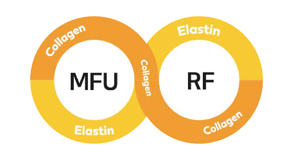 Sức mạnh công nghệ tổng hợp của MFU + RF.