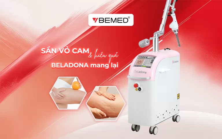 Chứng Sần Vỏ Cam và Phương Pháp Điều Trị Hiệu Quả Từ Thiết Bị BELADONA