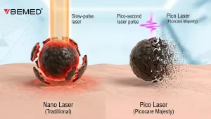 so-sanh-co-che-nano-laser-va-pico-laser-picocare-majesty.jpg