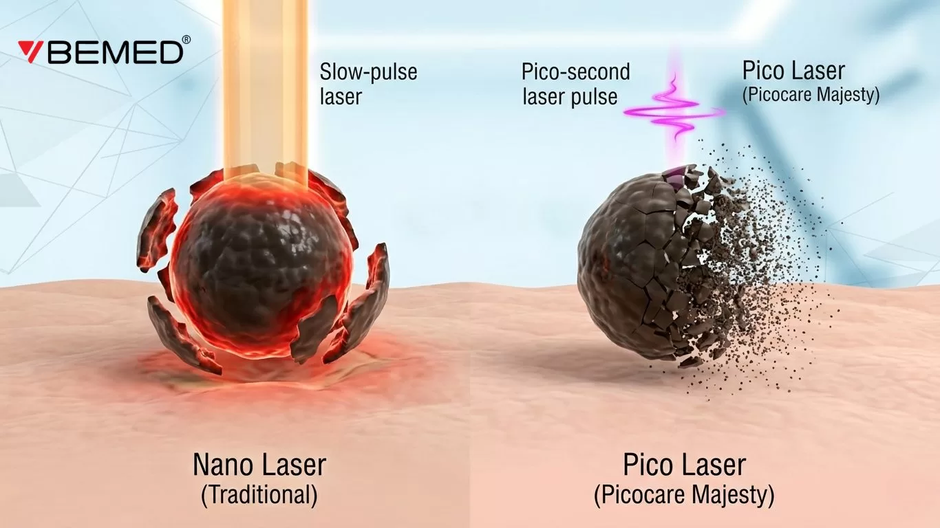 so-sanh-co-che-nano-laser-va-pico-laser-picocare-majesty.jpg